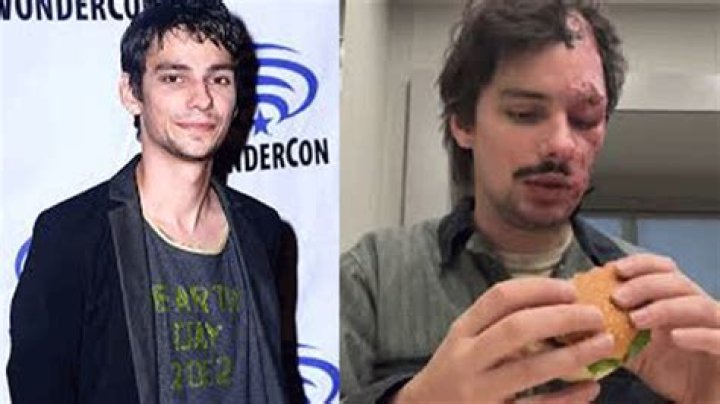 Devon Bostick Accident