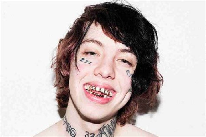Lil Xan Teeth